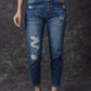 Blue Distressed Button Fly High Waist Skinny Jeans